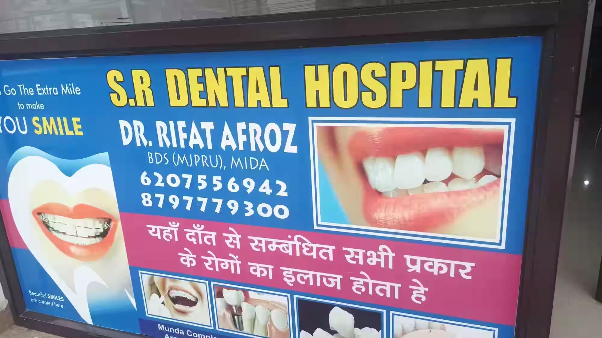S R Dental Hospital Exterior and Entrance View in Kathal More Rd Argora Ranchi